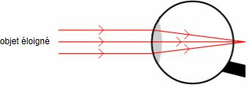 L'oeil hypermétrope au repos : un système pas assez convergent 