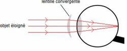 L'oeil hypermétrope au repos corrigé par une lentille convergente 