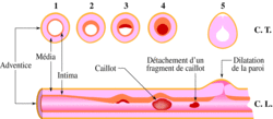 Pathologies de l'appareil cardiovasculaire - illustration 1