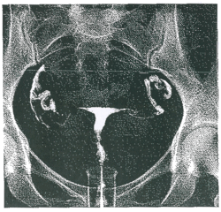 Un cancer féminin - illustration 2