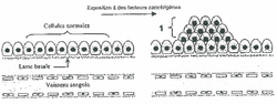 Étape A