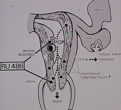Action du RU 486 au début de la grossesse - illustration 1