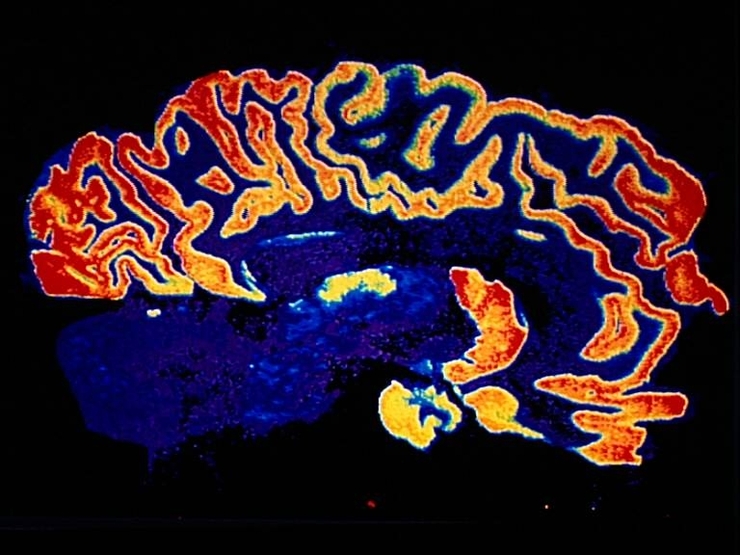 Récepteurs de l'acétylcholine dans le cerveau humain - illustration 1