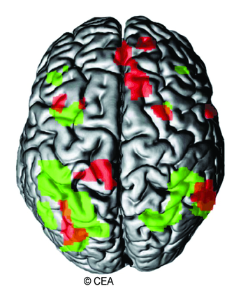Zones actives du cerveau - illustration 1