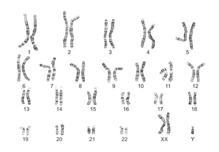 Les anomalies chromosomiques, exercice 1 - illustration 1